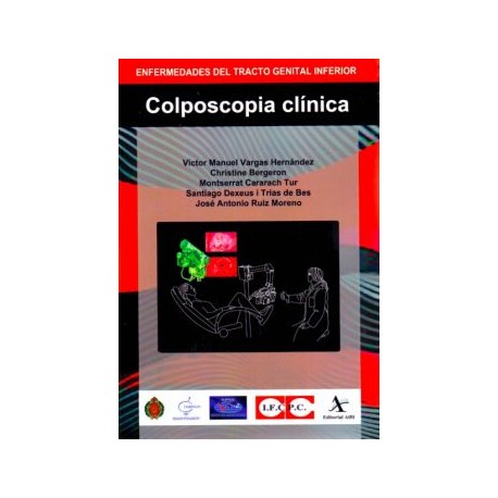 Colposcopia Clínica. Enfermedades del Tracto Genital Inferior (Alfil)
