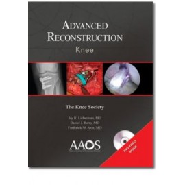 Advance Reconstruction: Knee